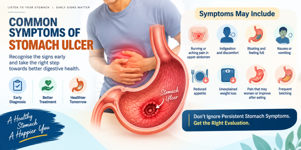 Common symptoms of stomach ulcer including upper abdominal pain, bloating, nausea, indigestion and loss of appetite